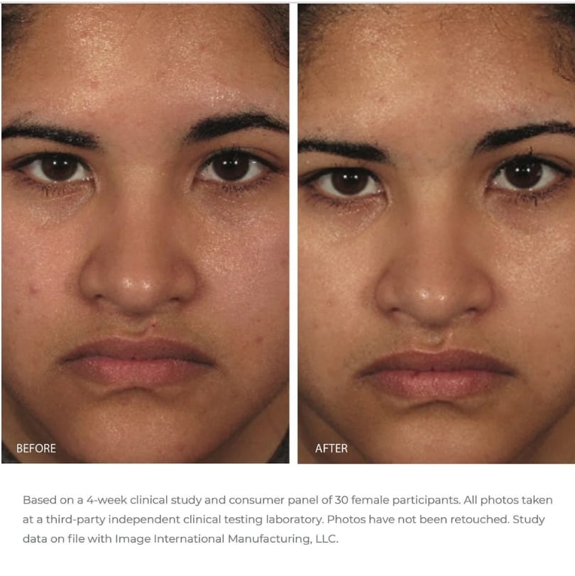 ORMEDIC balancing gel polisher