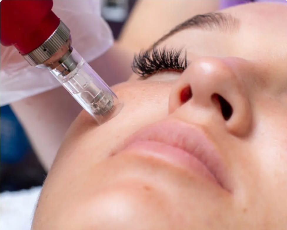 Microneedling facial ( 1hr of Service)