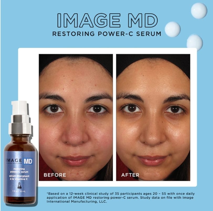 IMAGE MD restoring power c serum