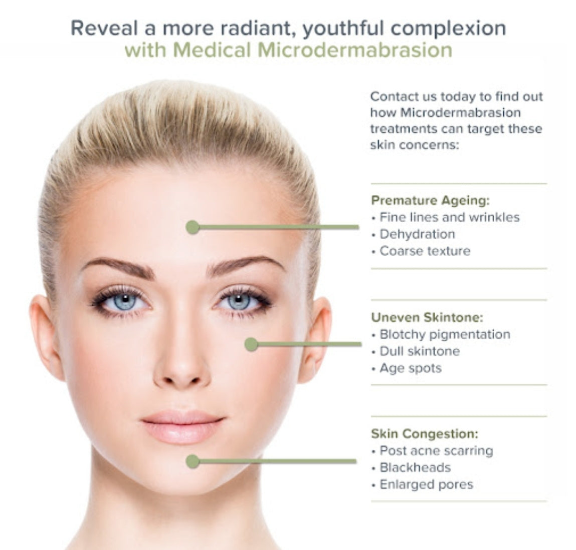 Microdermabrasion (25 min of Service)