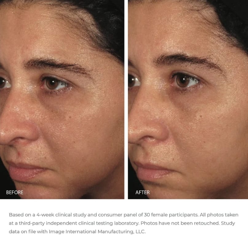 ORMEDIC balancing biopeptide crème